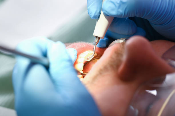Best Emergency Root Canal Therapy in Alma, NE
